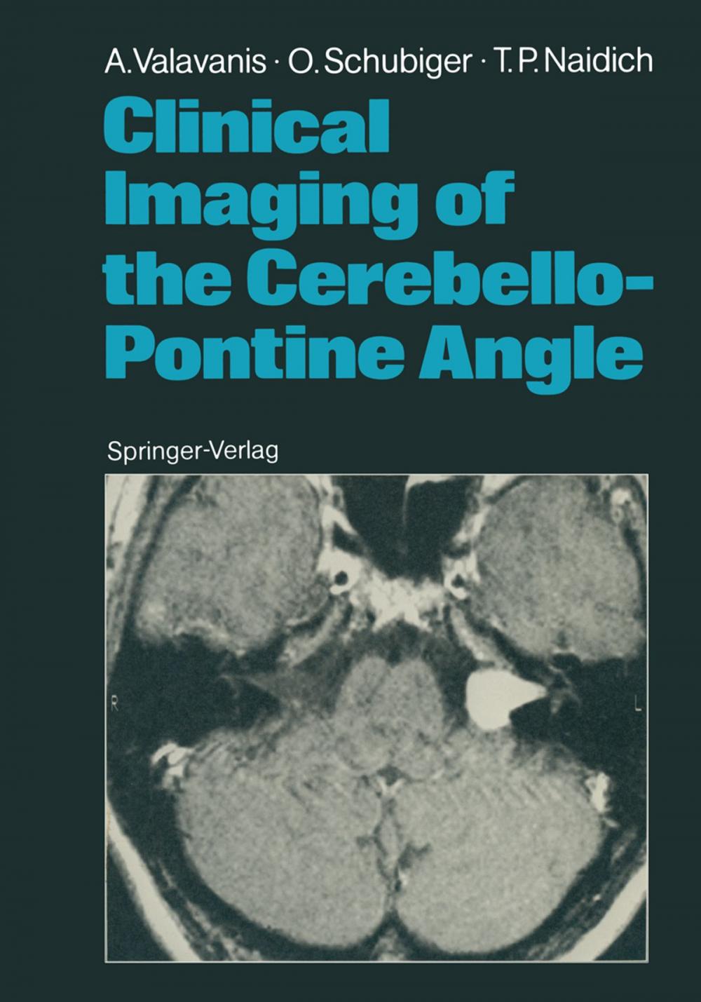 Big bigCover of Clinical Imaging of the Cerebello-Pontine Angle