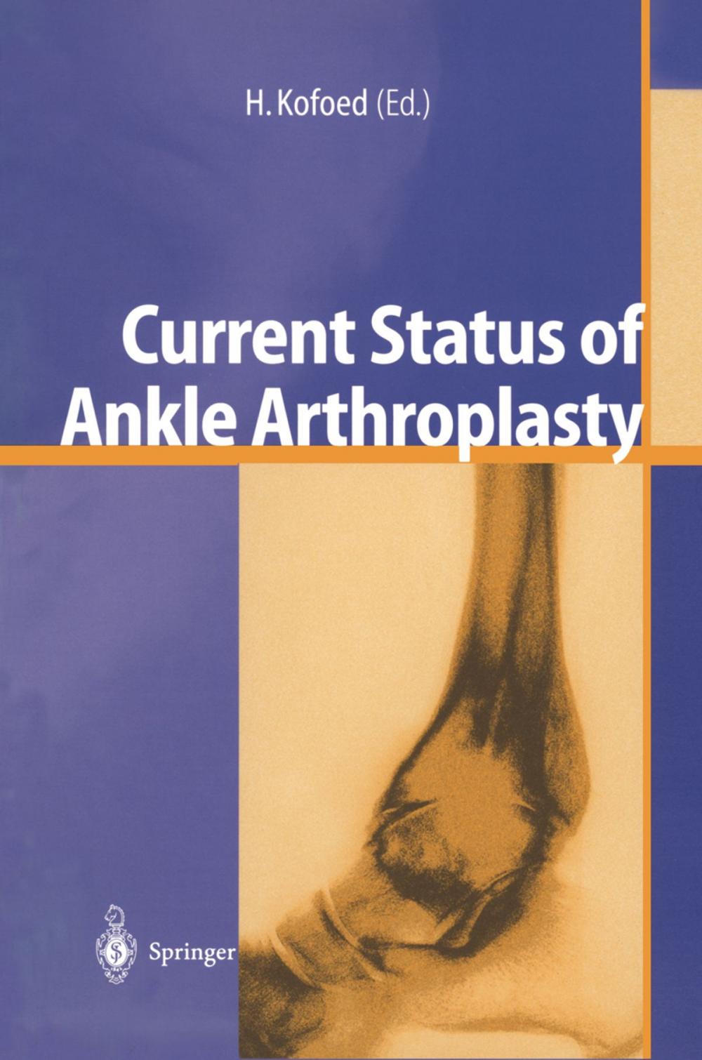 Big bigCover of Current Status of Ankle Arthroplasty