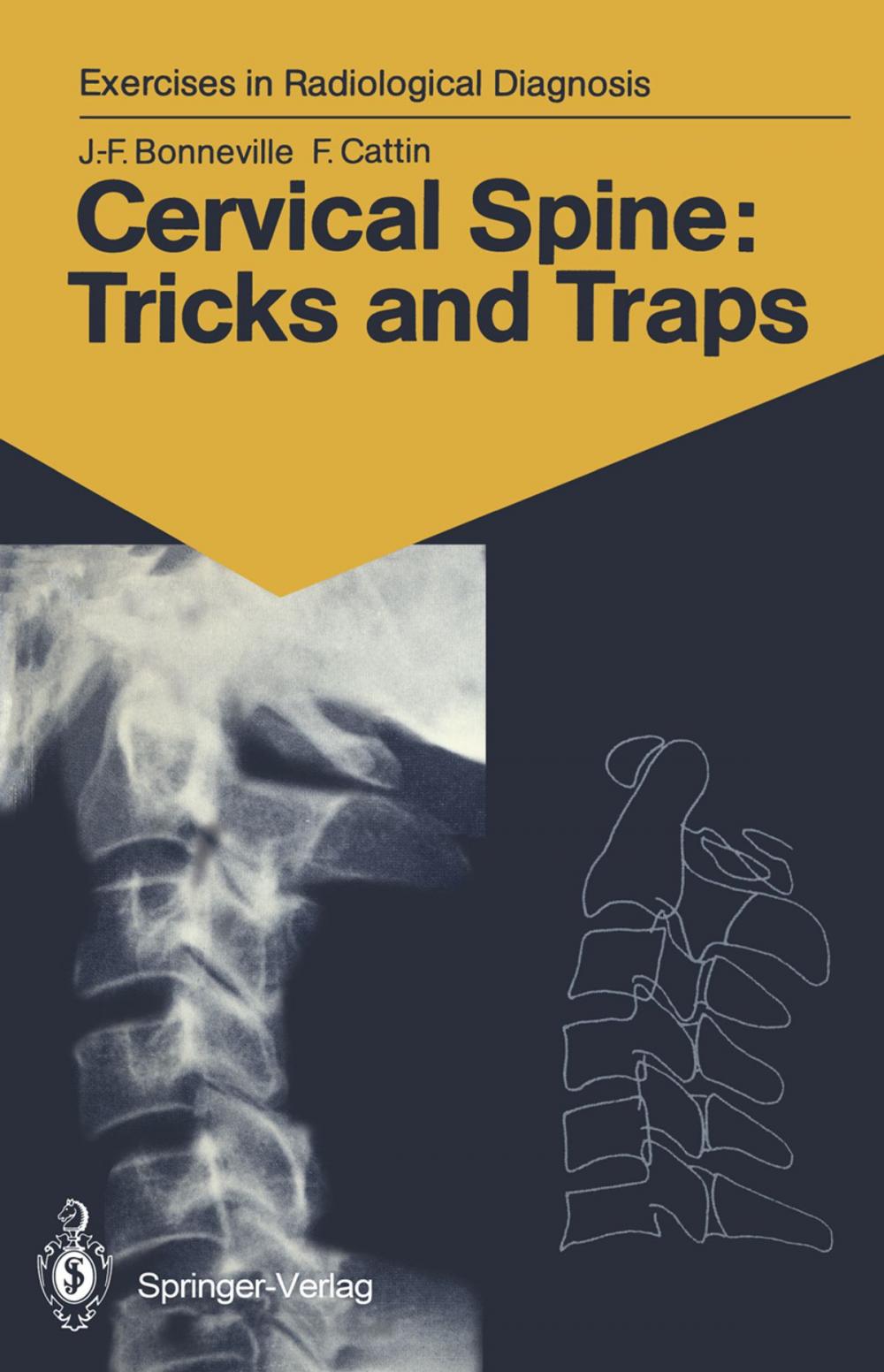 Big bigCover of Cervical Spine: Tricks and Traps