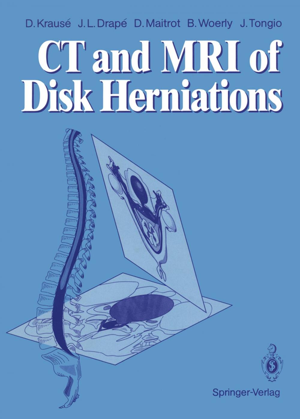 Big bigCover of CT and MRI of Disk Herniations