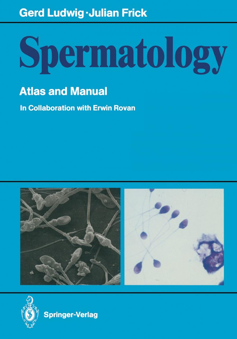 Big bigCover of Spermatology