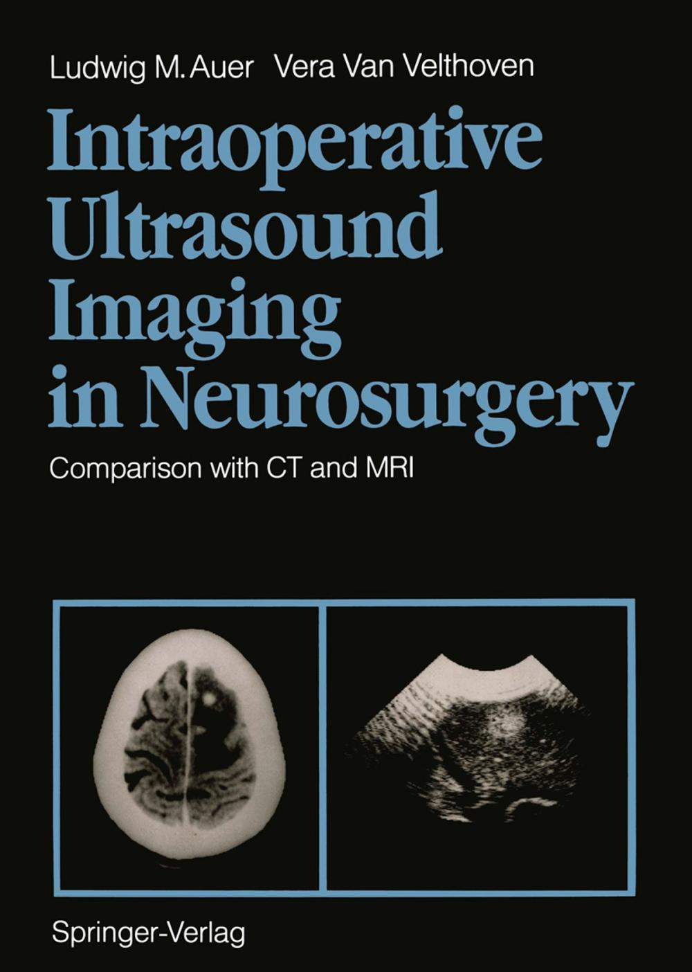 Big bigCover of Intraoperative Ultrasound Imaging in Neurosurgery