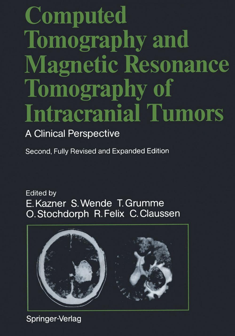 Big bigCover of Computed Tomography and Magnetic Resonance Tomography of Intracranial Tumors