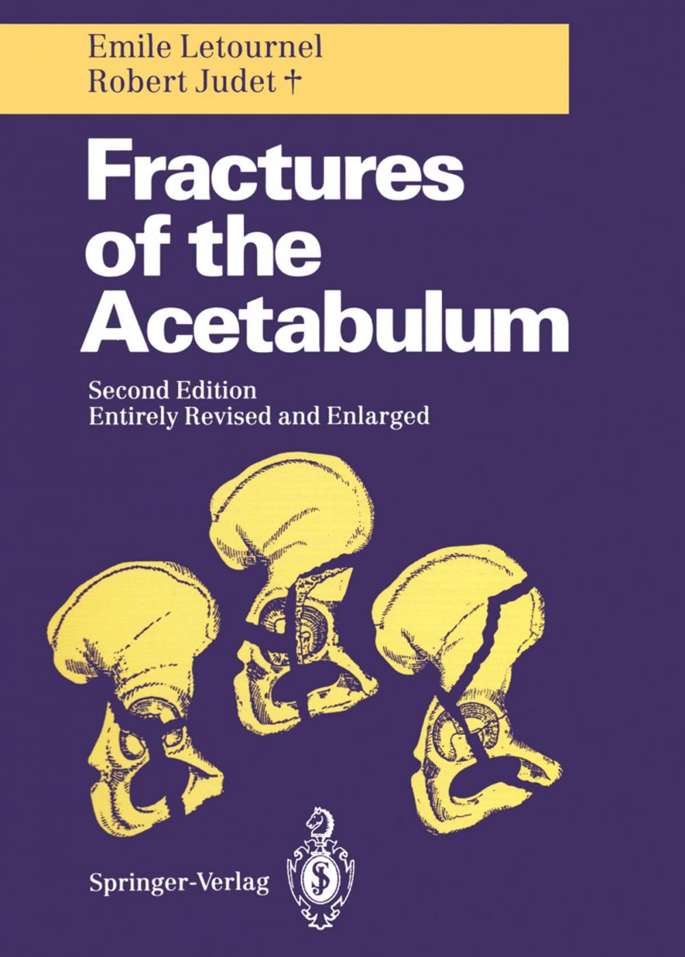 Big bigCover of Fractures of the Acetabulum