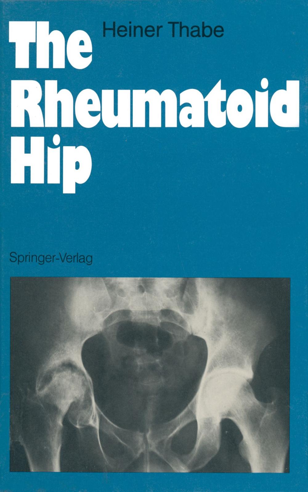 Big bigCover of The Rheumatoid Hip