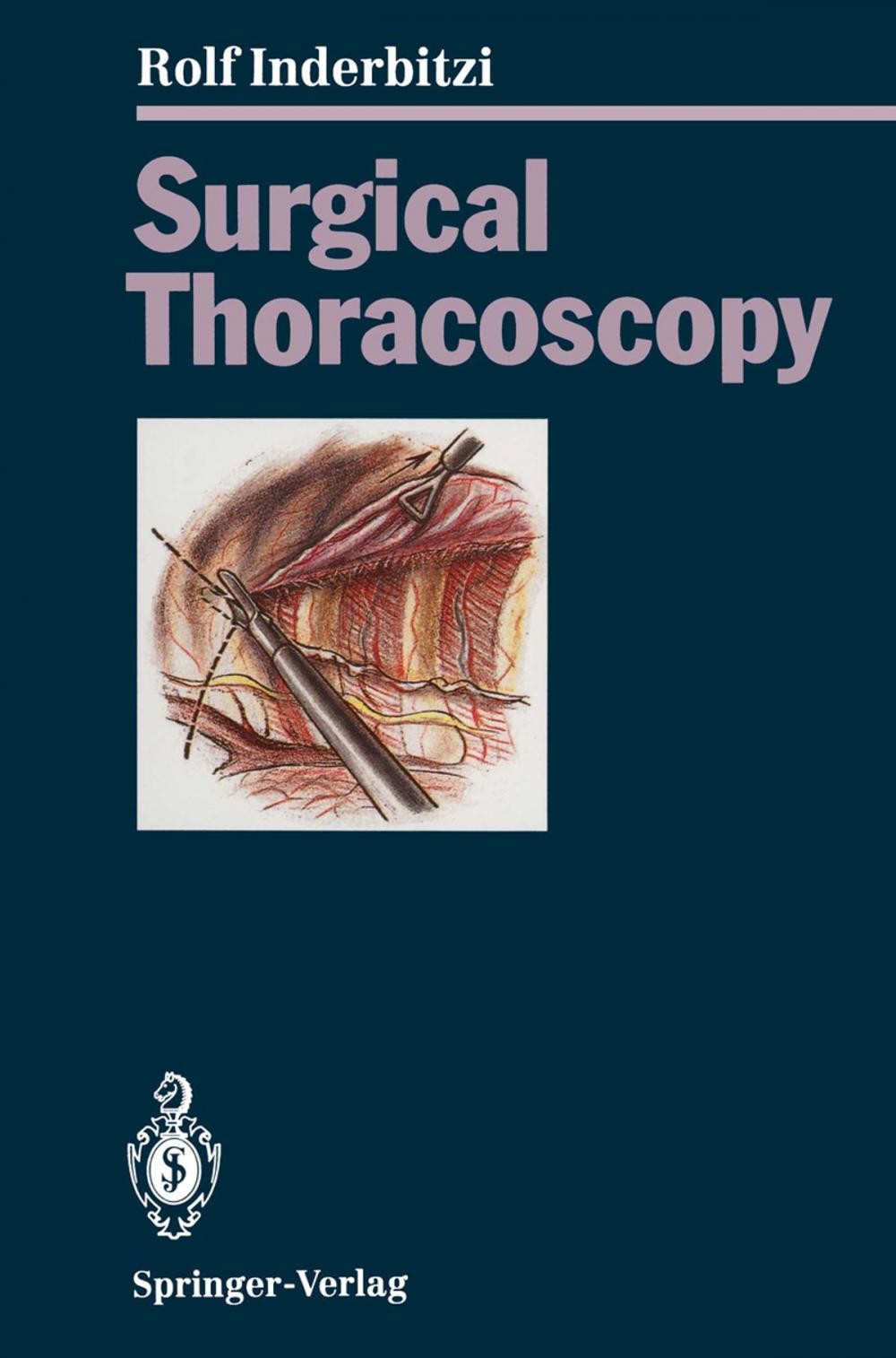 Big bigCover of Surgical Thoracoscopy