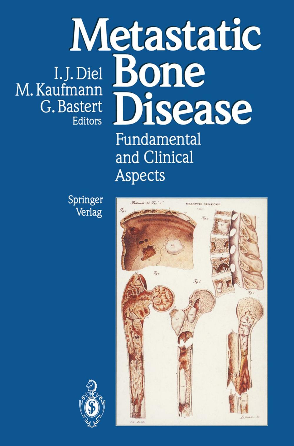 Big bigCover of Metastatic Bone Disease