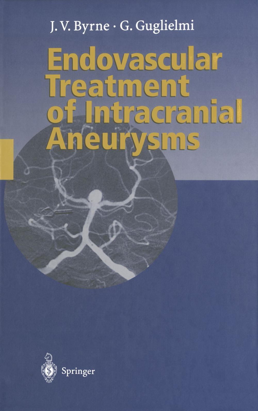 Big bigCover of Endovascular Treatment of Intracranial Aneurysms