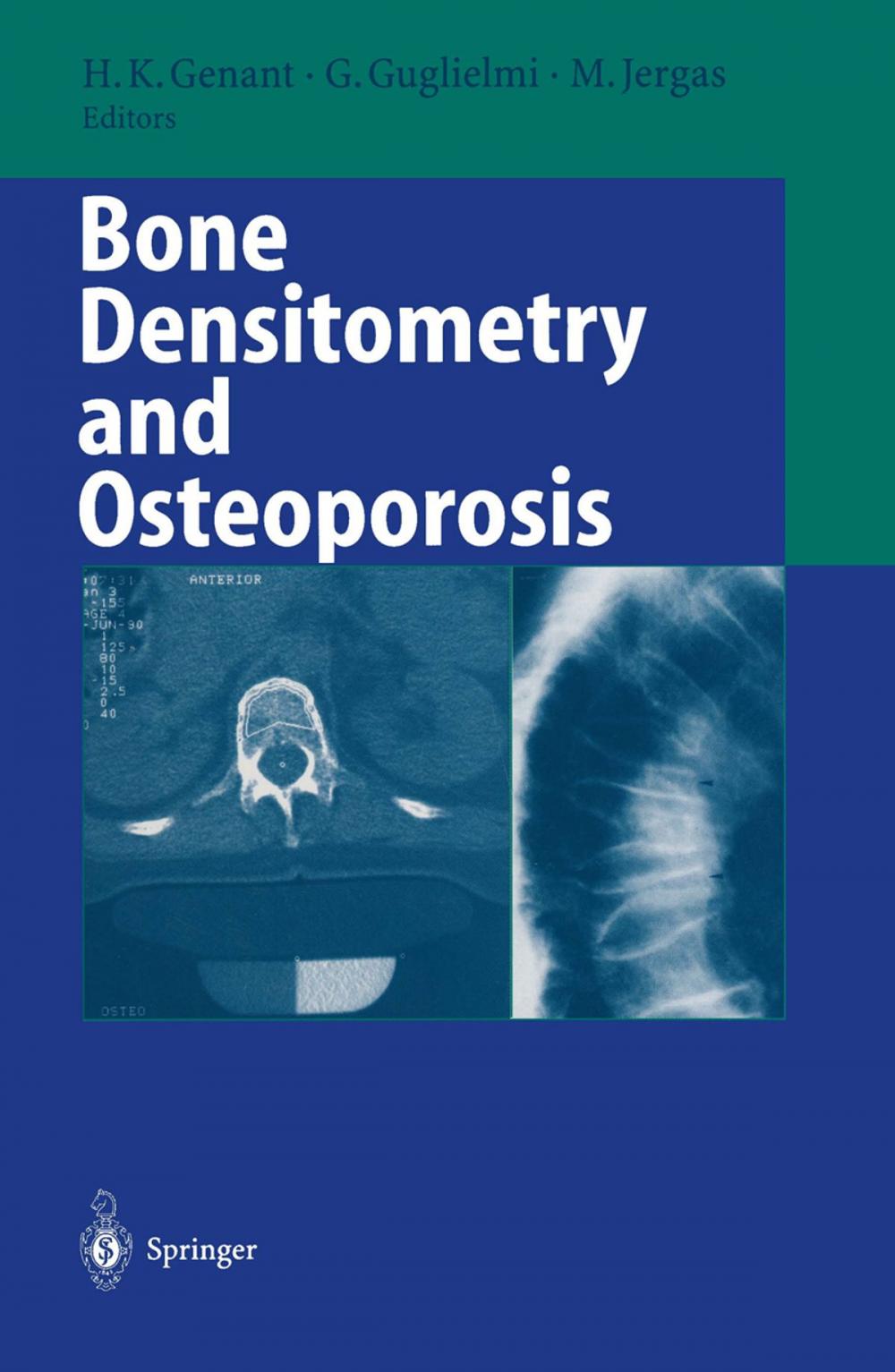 Big bigCover of Bone Densitometry and Osteoporosis