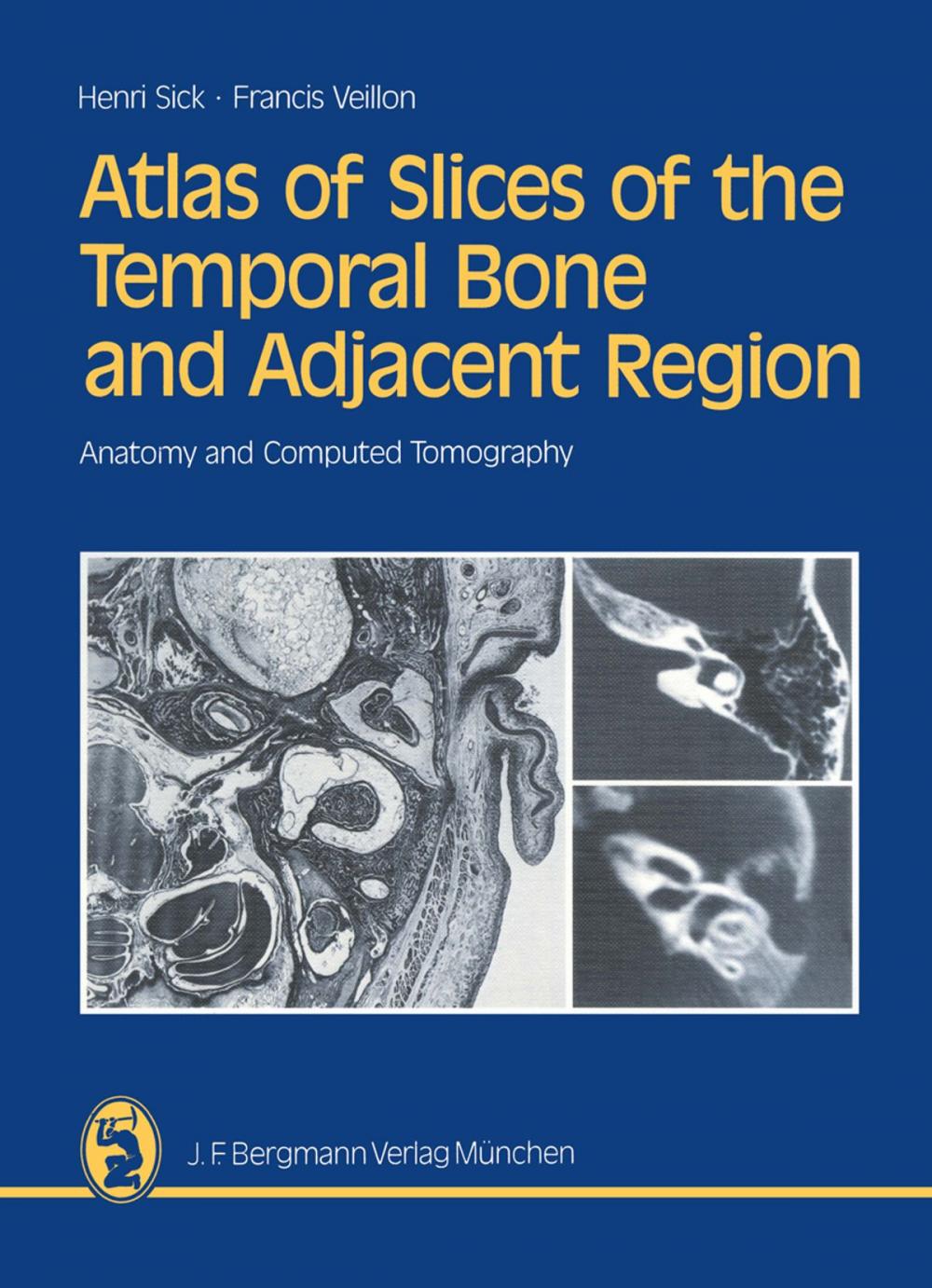 Big bigCover of Atlas of Slices of the Temporal Bone and Adjacent Region