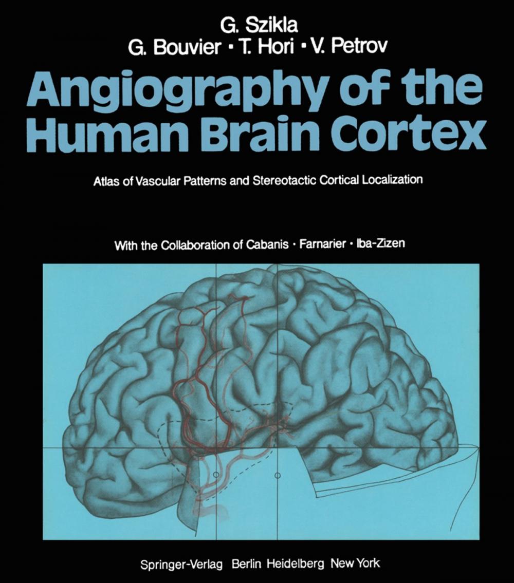 Big bigCover of Angiography of the Human Brain Cortex