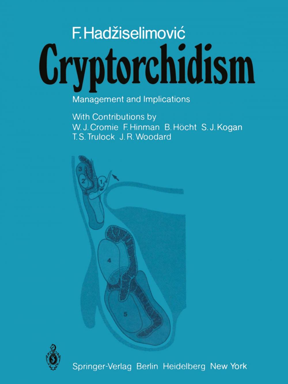 Big bigCover of Cryptorchidism