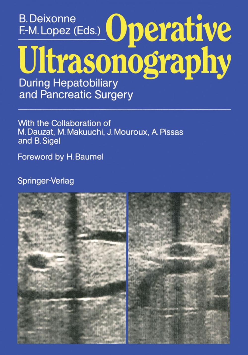 Big bigCover of Operative Ultrasonography