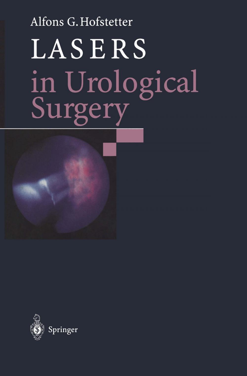 Big bigCover of Lasers in Urological Surgery