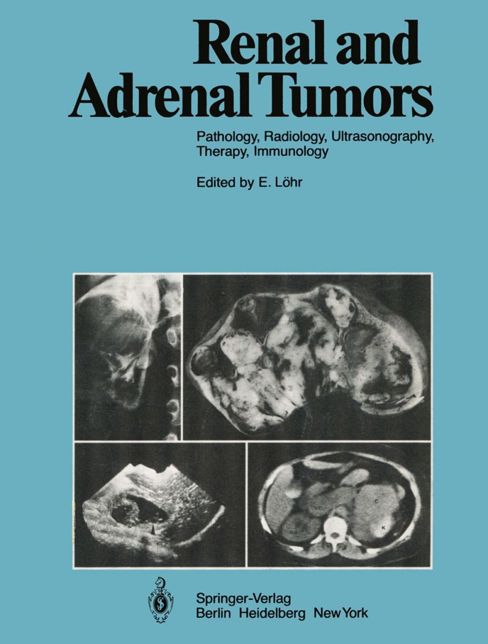 Big bigCover of Renal and Adrenal Tumors