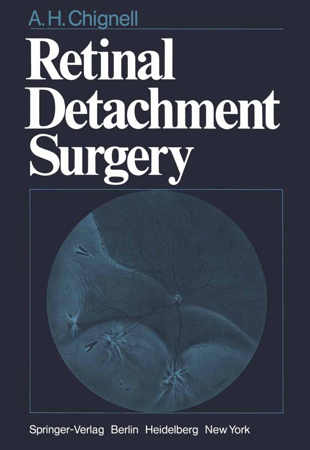 Big bigCover of Retinal Detachment Surgery