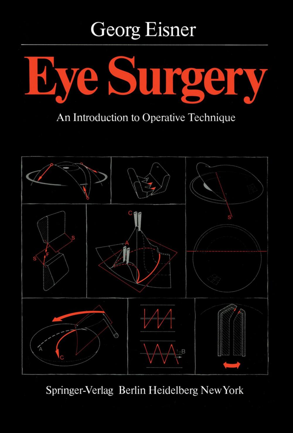 Big bigCover of Eye Surgery