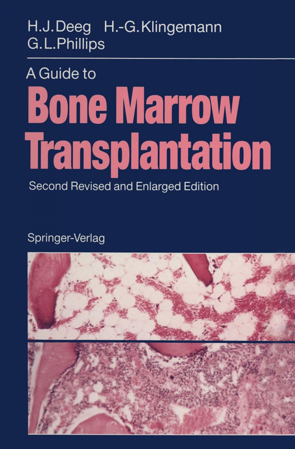 Big bigCover of A Guide to Bone Marrow Transplantation