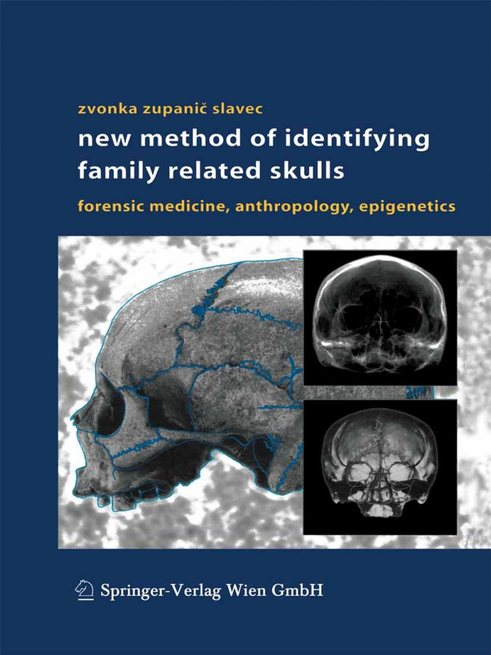 Big bigCover of New Method of Identifying Family Related Skulls