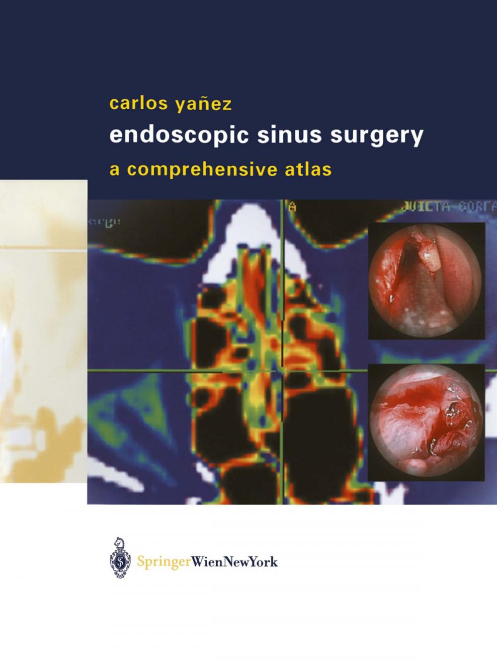 Big bigCover of Endoscopic Sinus Surgery