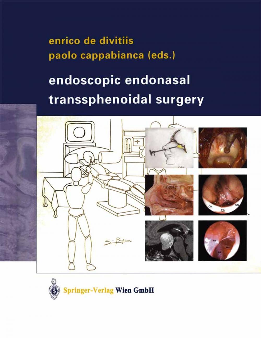 Big bigCover of Endoscopic Endonasal Transsphenoidal Surgery