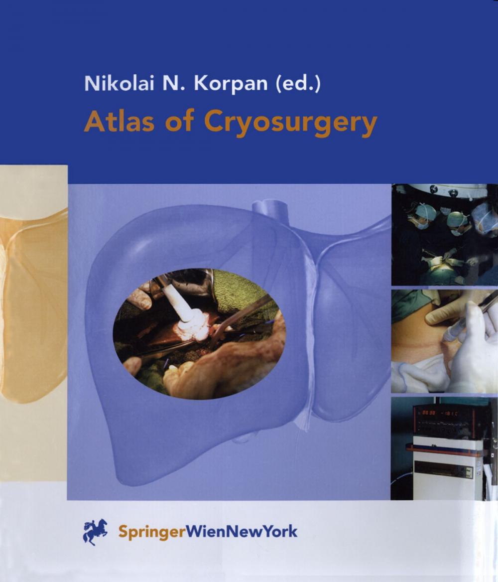 Big bigCover of Atlas of Cryosurgery