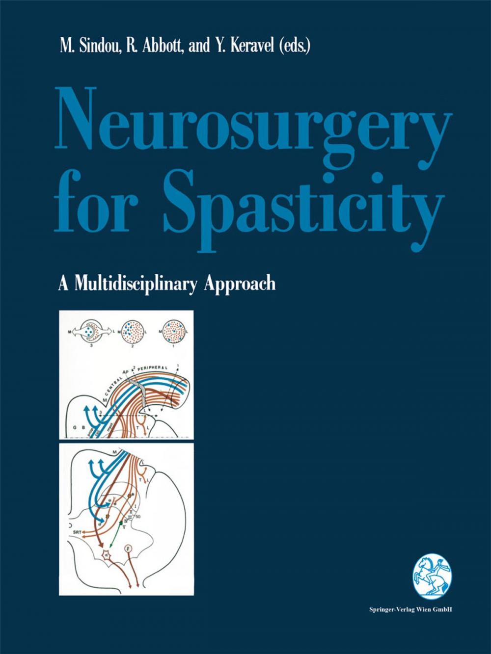 Big bigCover of Neurosurgery for Spasticity