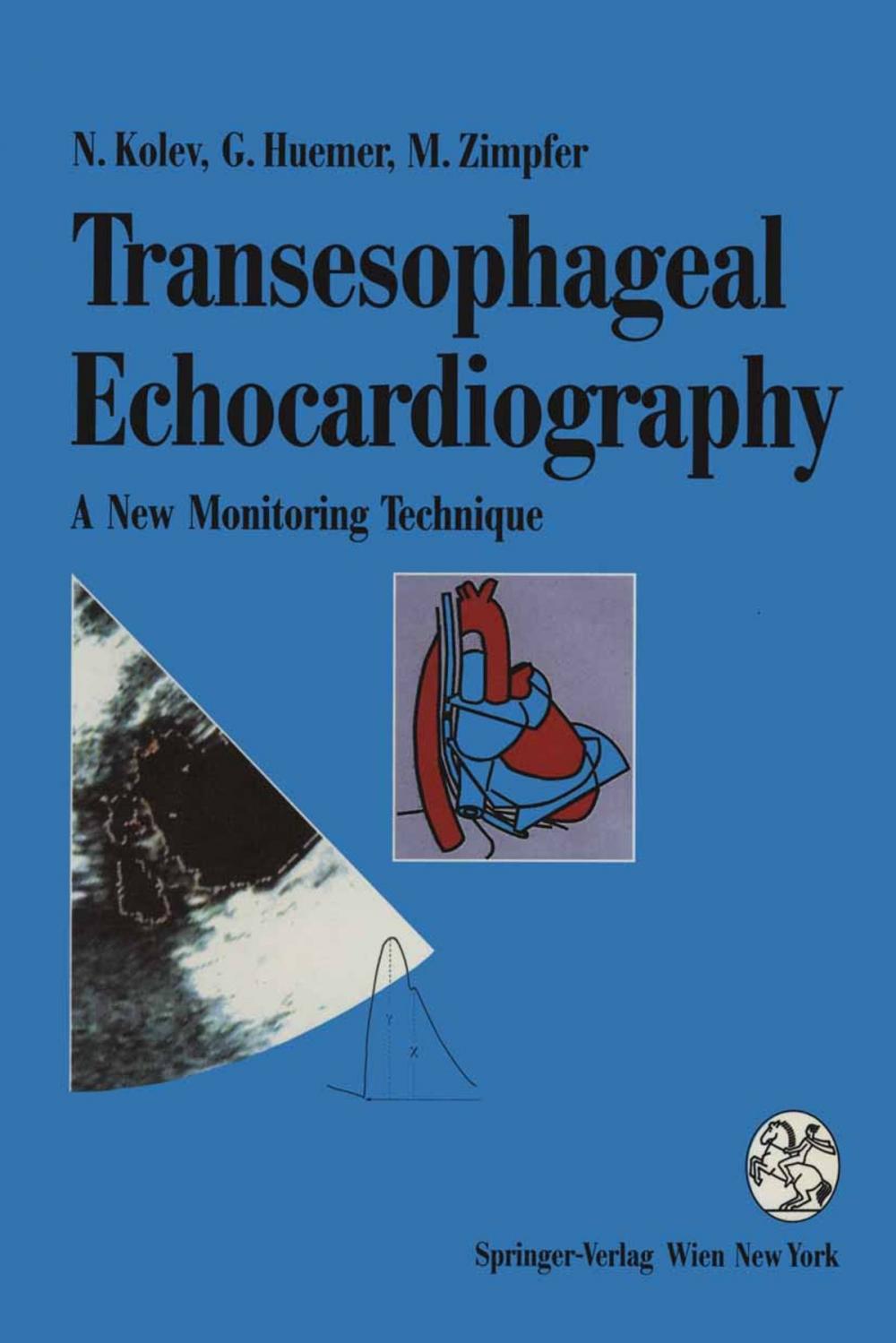 Big bigCover of Transesophageal Echocardiography