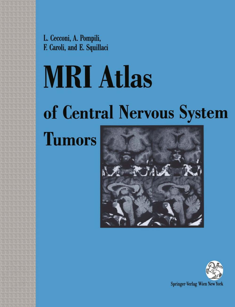 Big bigCover of MRI Atlas of Central Nervous System Tumors