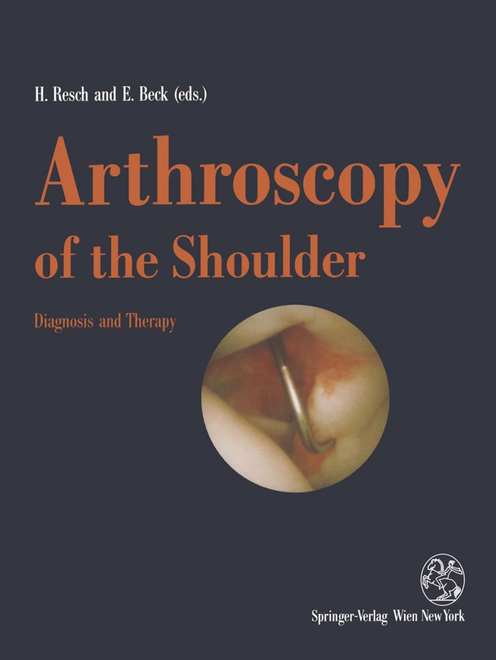 Big bigCover of Arthroscopy of the Shoulder