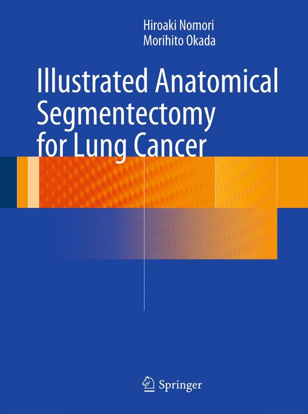 Big bigCover of Illustrated Anatomical Segmentectomy for Lung Cancer