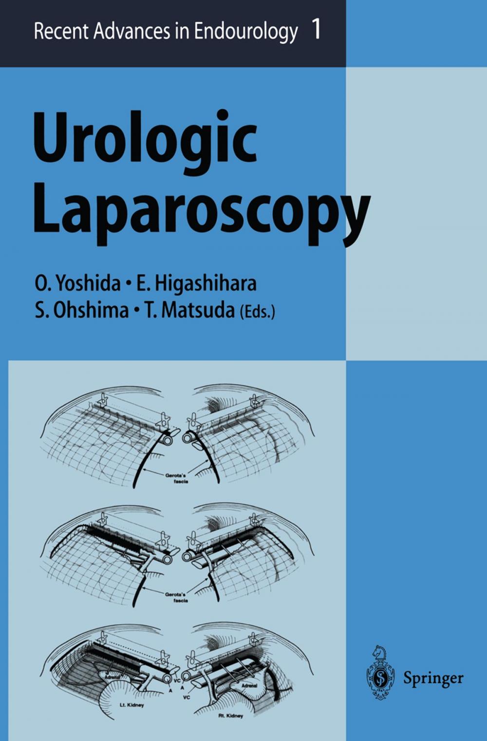 Big bigCover of Urologic Laparoscopy