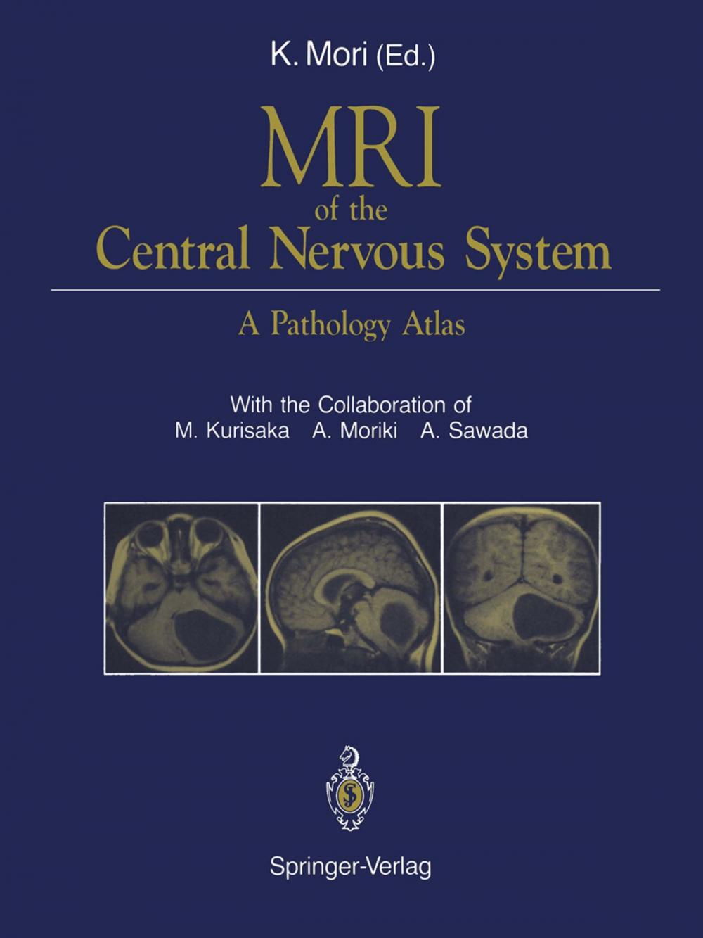 Big bigCover of MRI of the Central Nervous System