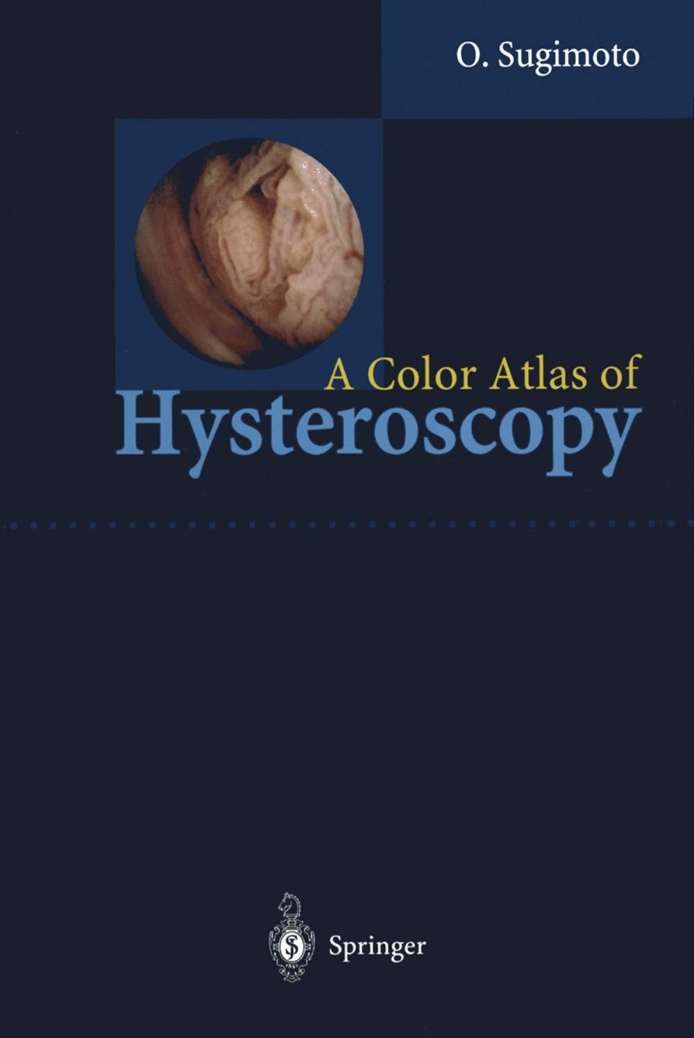 Big bigCover of A Color Atlas of Hysteroscopy