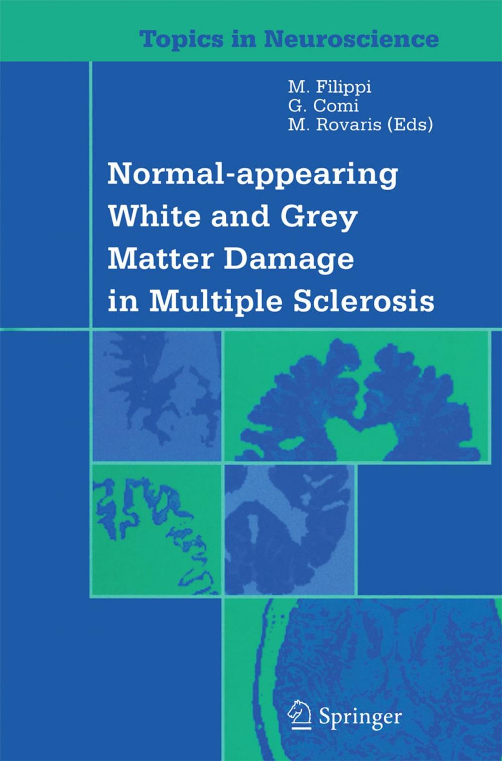 Big bigCover of Normal-appearing White and Grey Matter Damage in Multiple Sclerosis