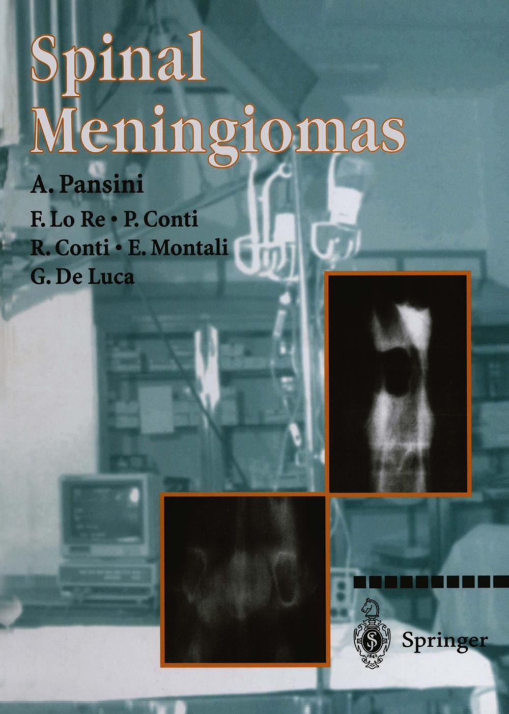 Big bigCover of Spinal Meningiomas