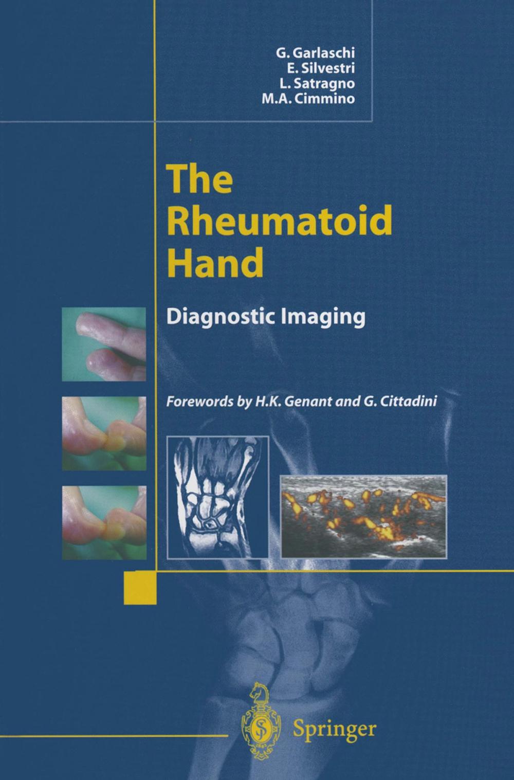 Big bigCover of The Rheumatoid Hand