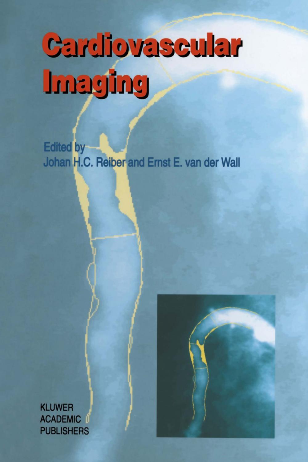 Big bigCover of Cardiovascular Imaging