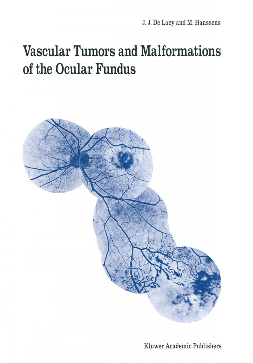 Big bigCover of Vascular Tumors and Malformations of the Ocular Fundus