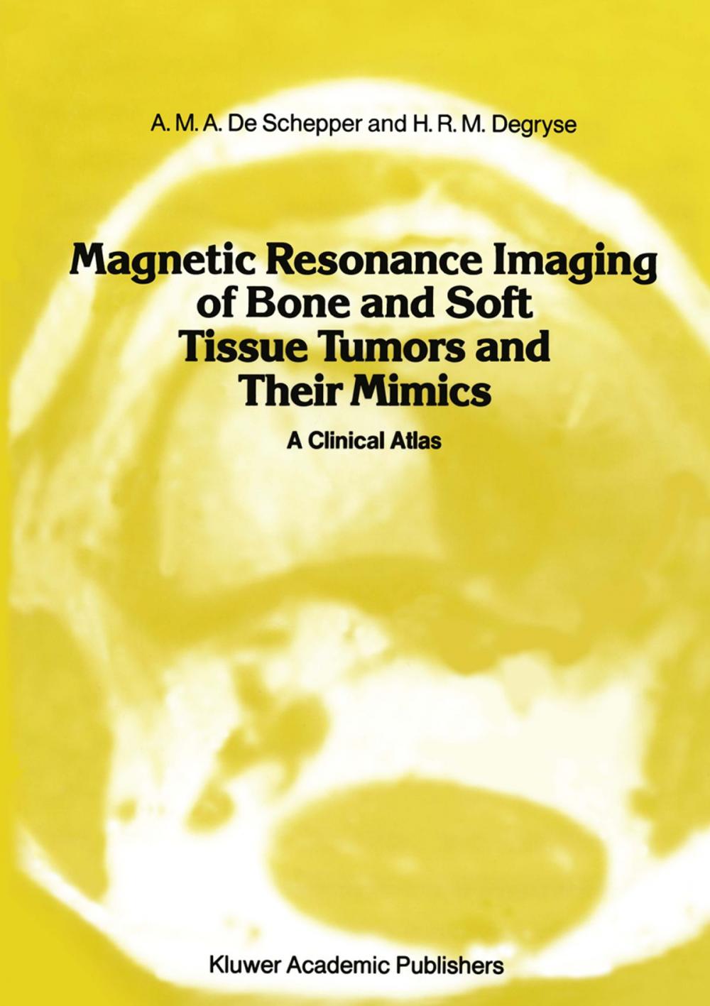 Big bigCover of Magnetic Resonance Imaging of Bone and Soft Tissue Tumors and Their Mimics