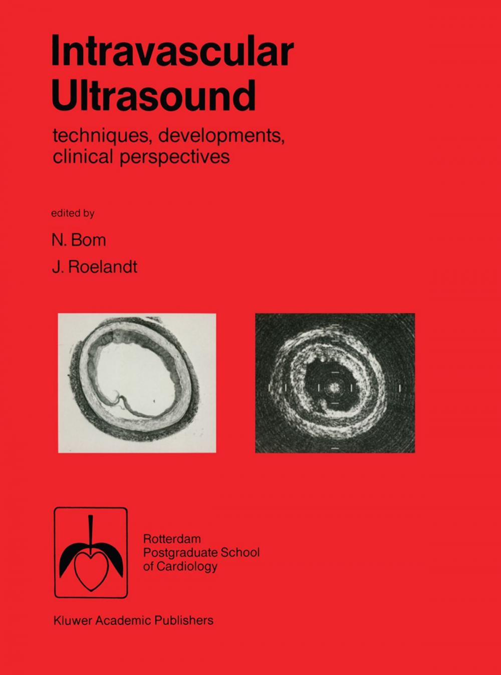 Big bigCover of Intravascular ultrasound