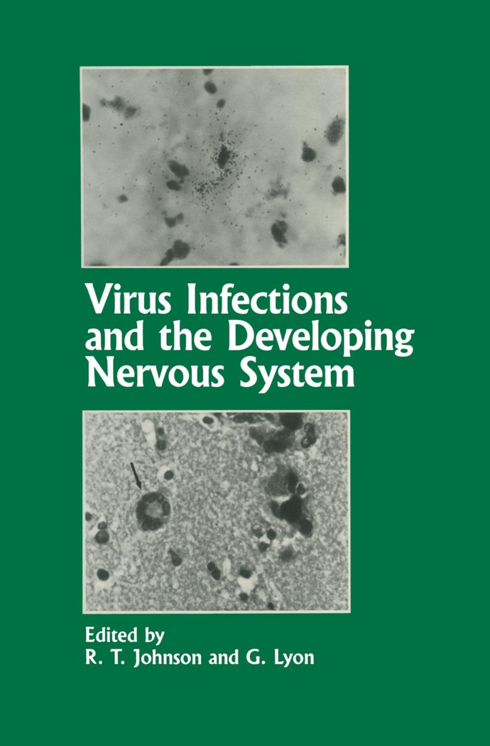 Big bigCover of Virus Infections and the Developing Nervous System