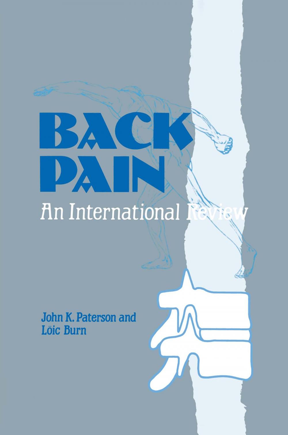 Big bigCover of Back Pain