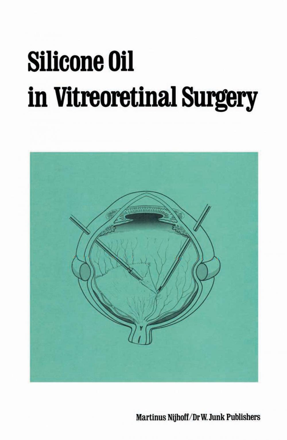 Big bigCover of Silicone Oil in Vitreoretinal Surgery