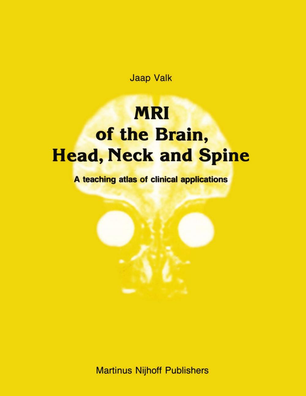 Big bigCover of MRI of the Brain, Head, Neck and Spine