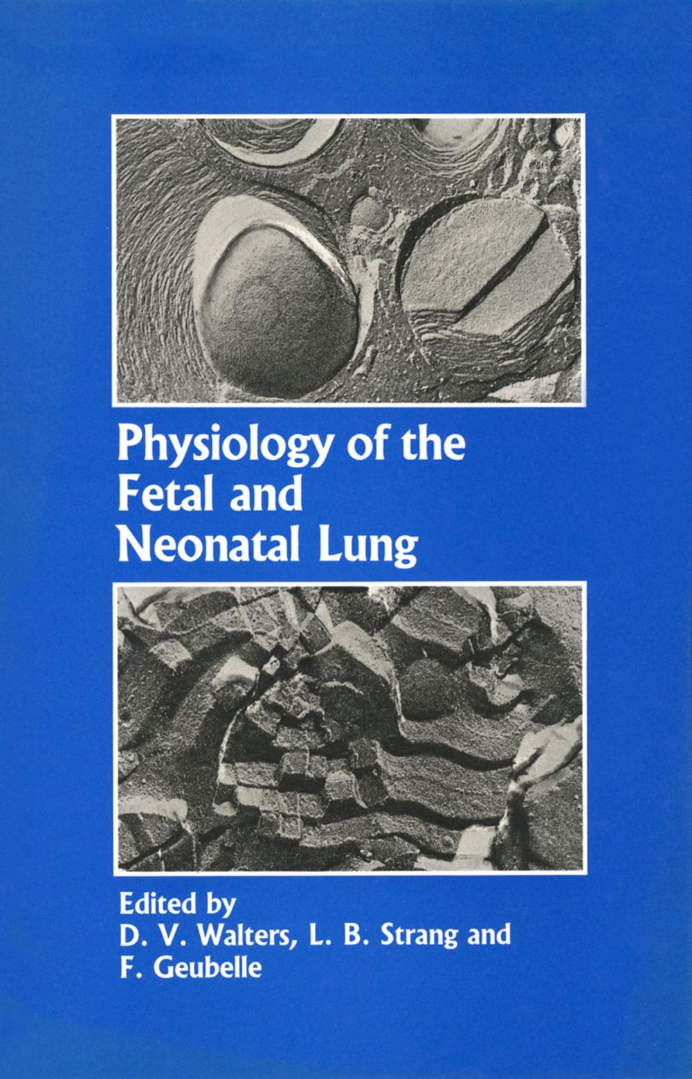 Big bigCover of Physiology of the Fetal and Neonatal Lung