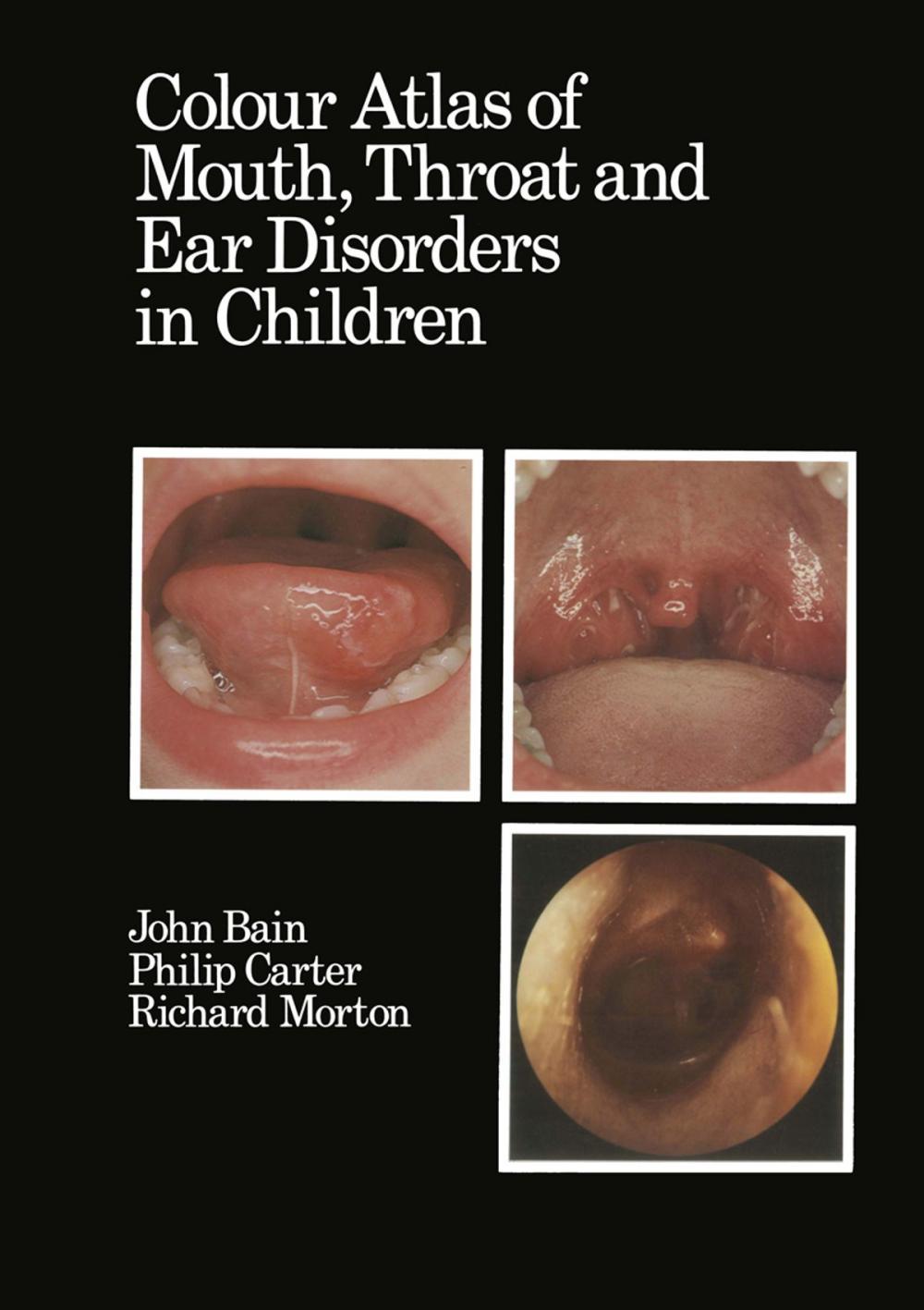 Big bigCover of Colour Atlas of Mouth, Throat and Ear Disorders in Children