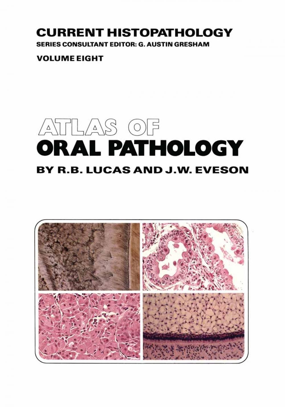 Big bigCover of Atlas of Oral Pathology