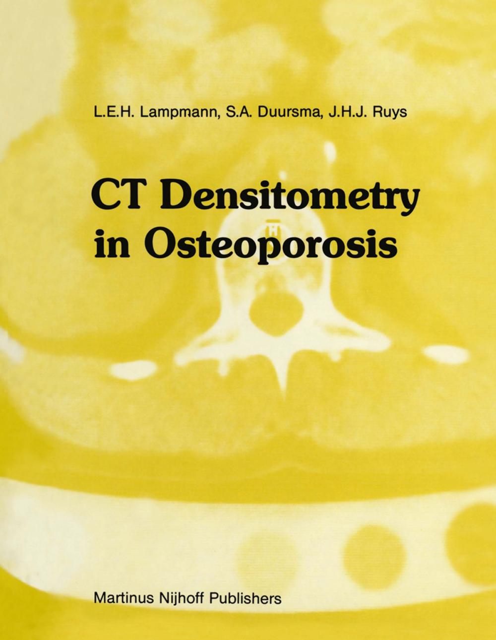 Big bigCover of CT Densitometry in Osteoporosis