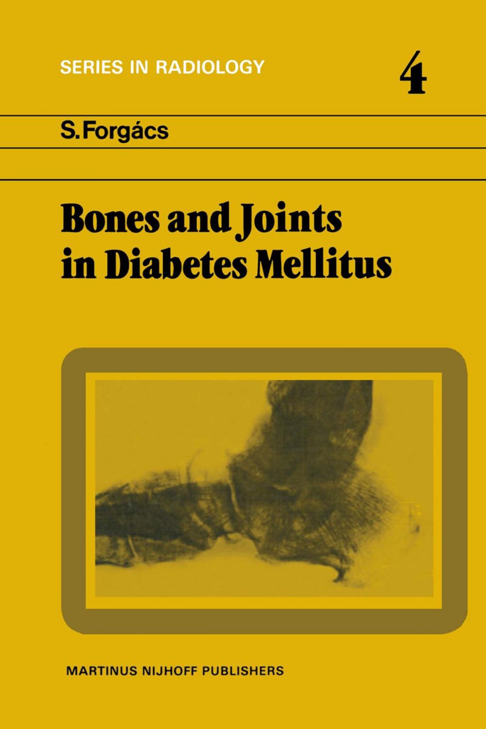 Big bigCover of Bones and Joints in Diabetes Mellitus